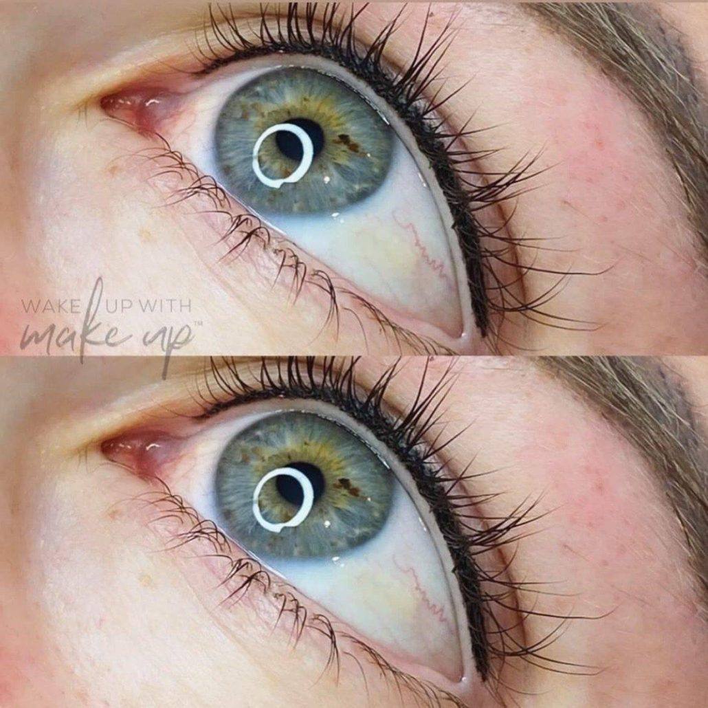 Permanent eyeliner tattooing